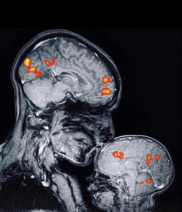 Familias ConCiencia los bebés transforman el cerebro de la madre